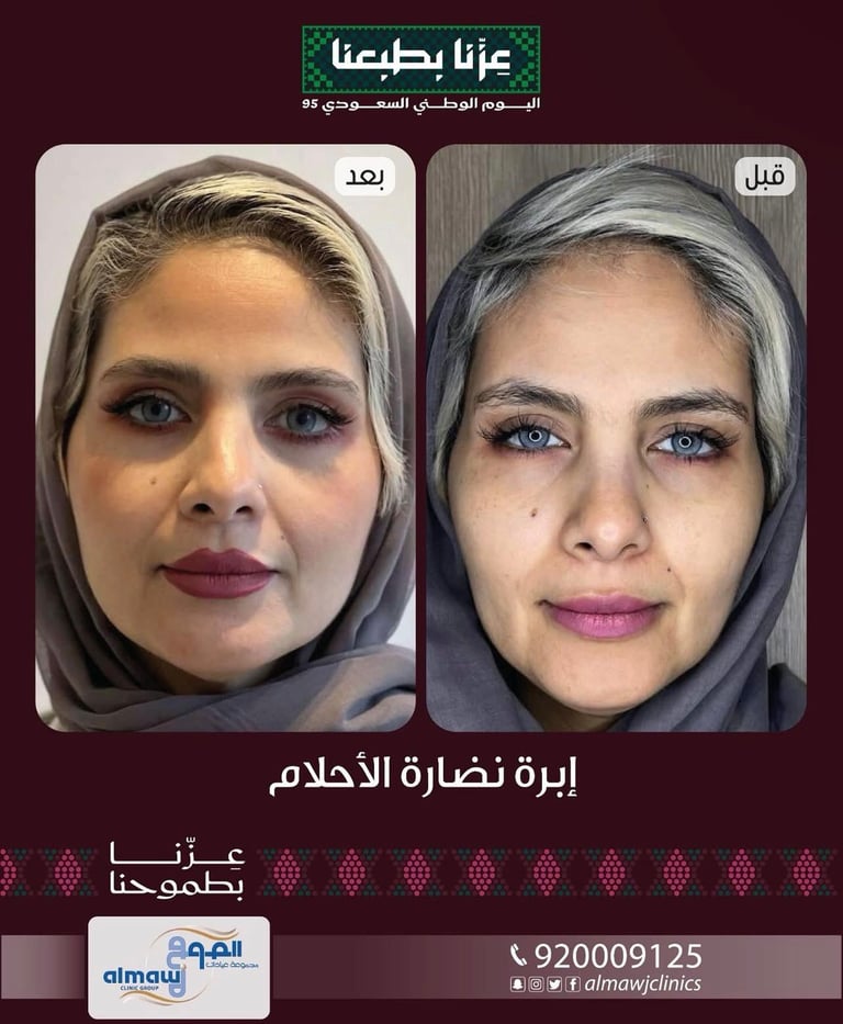 قبل وبعد علاج البشرة